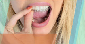 Woman placing a mouth guard